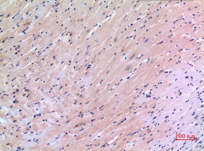 VEGFC Antibody