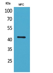 Alpha Smooth Muscle Actin Rabbit Polyclonal Antibody