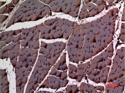 Alpha Smooth Muscle Actin Rabbit Polyclonal Antibody