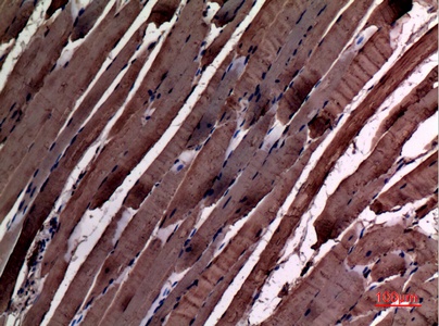 Alpha Smooth Muscle Actin Rabbit Polyclonal Antibody