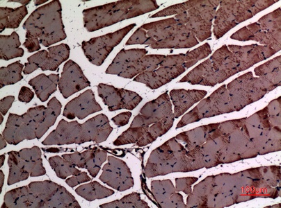 Alpha Smooth Muscle Actin Rabbit Polyclonal Antibody