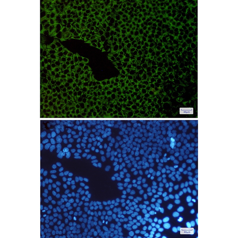 G3BP1 Antibody
