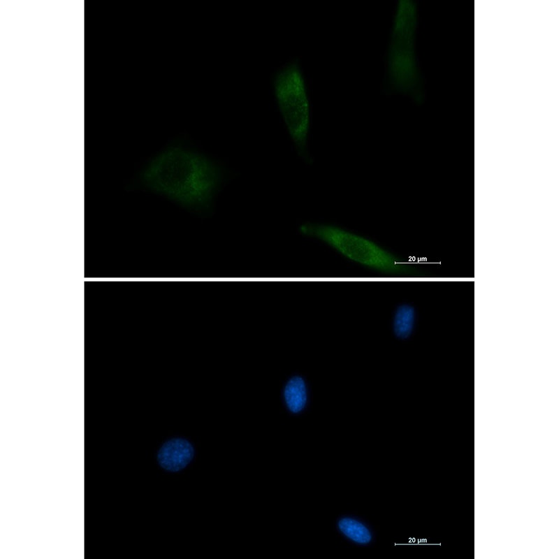 EGFR Antibody