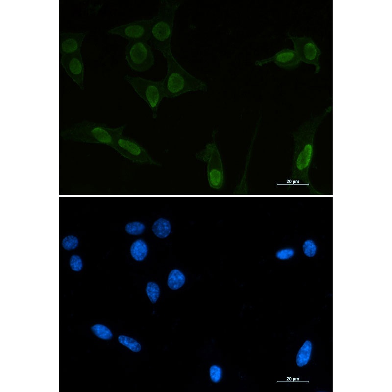 TP53 Antibody