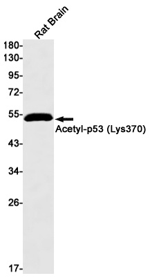 TP53 Antibody