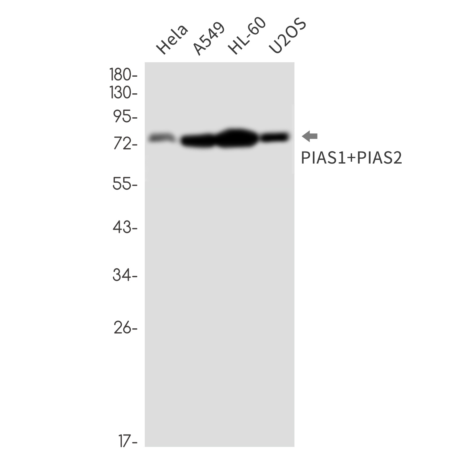 PIAS1/2 Rabbit Monoclonal Antibody