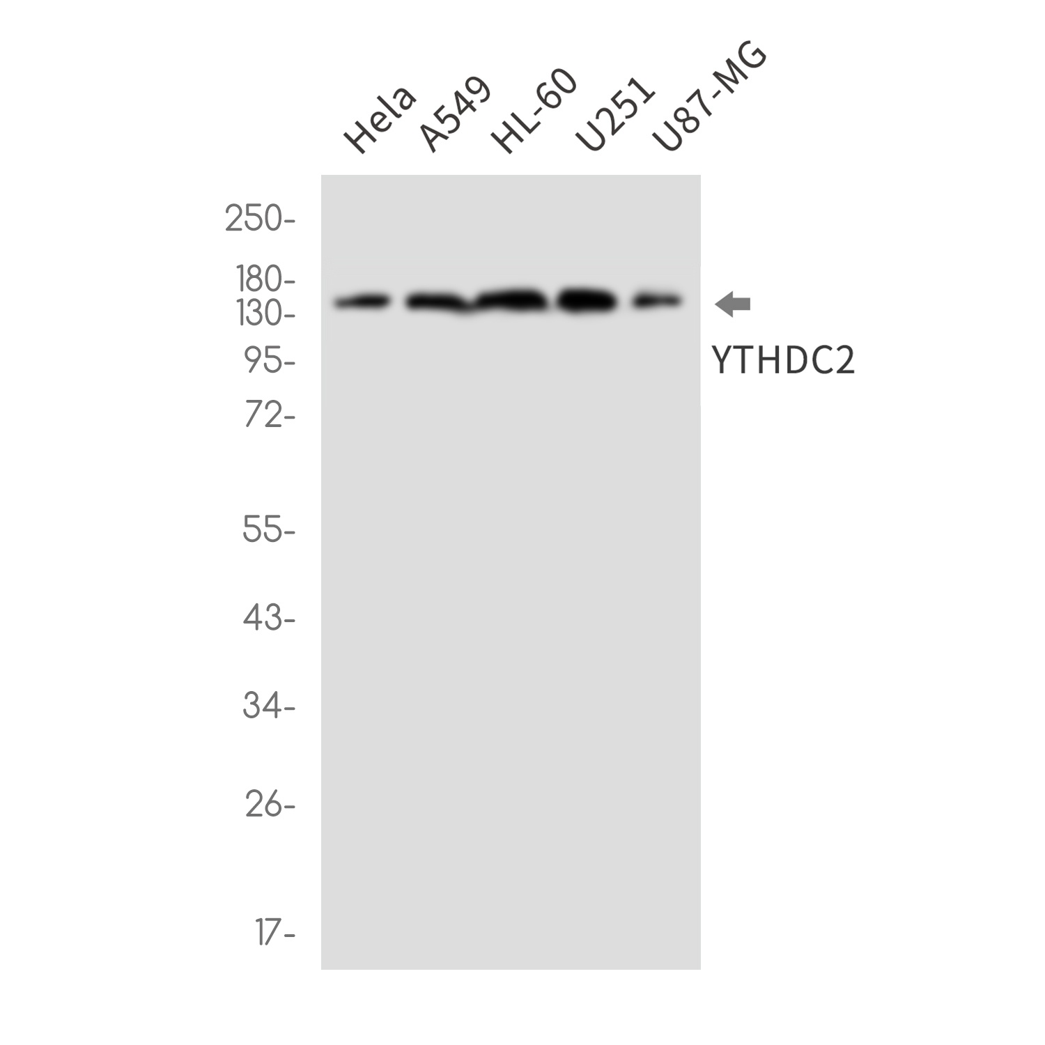 Ythdc2 Antibody