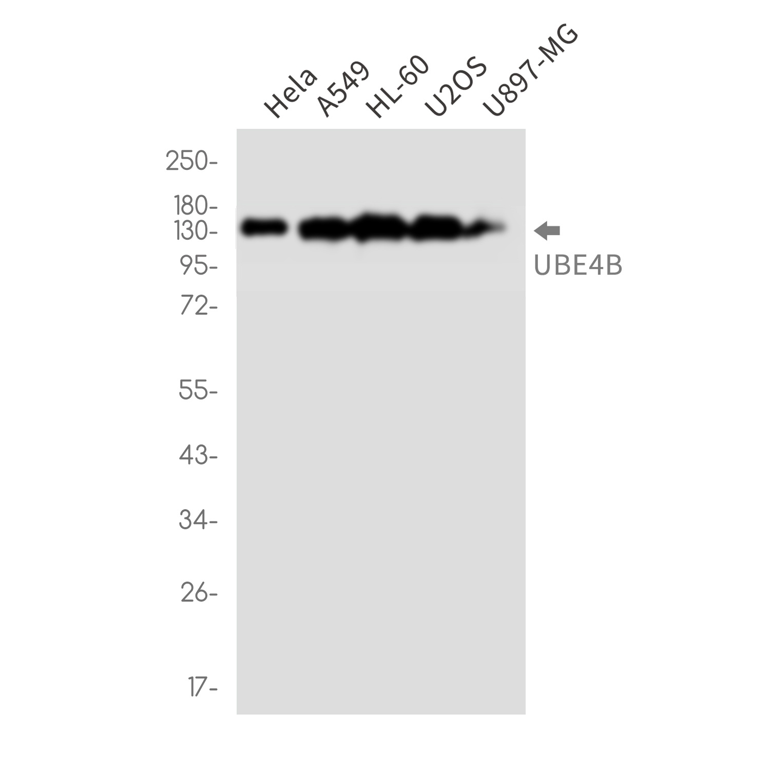 UBE4B Antibody