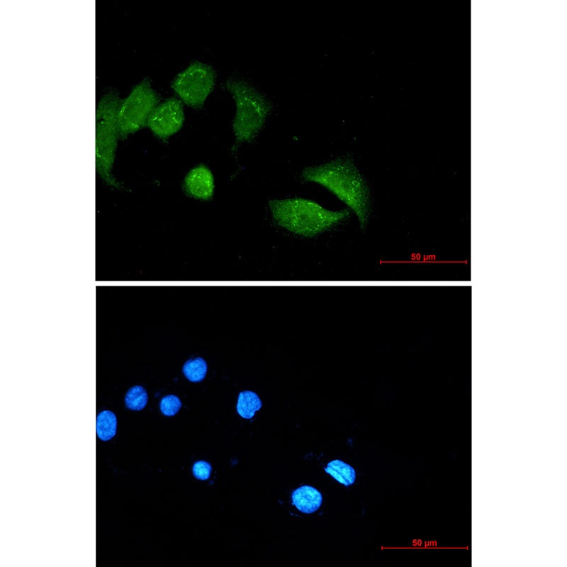UBE4B Antibody