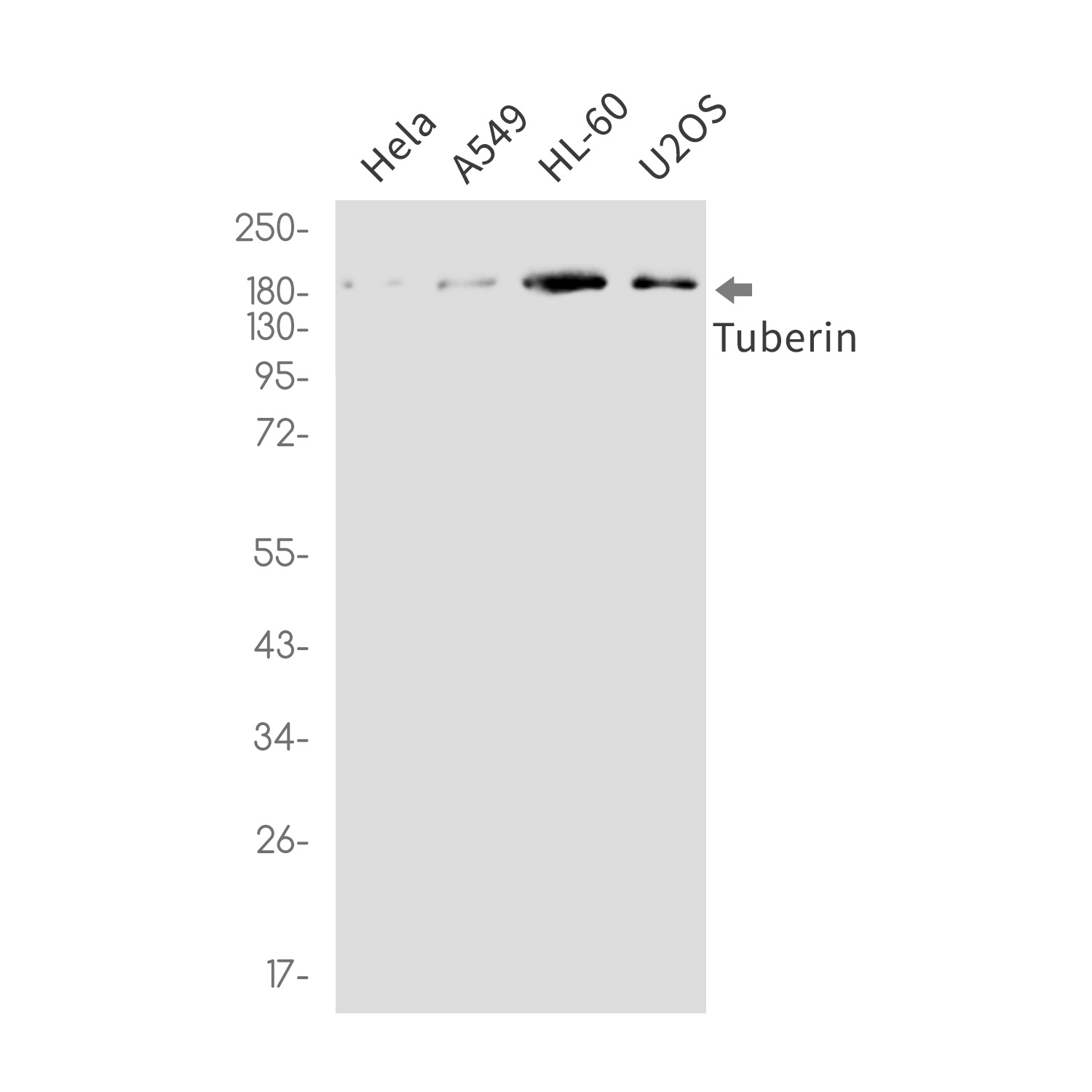 TSC2 Antibody