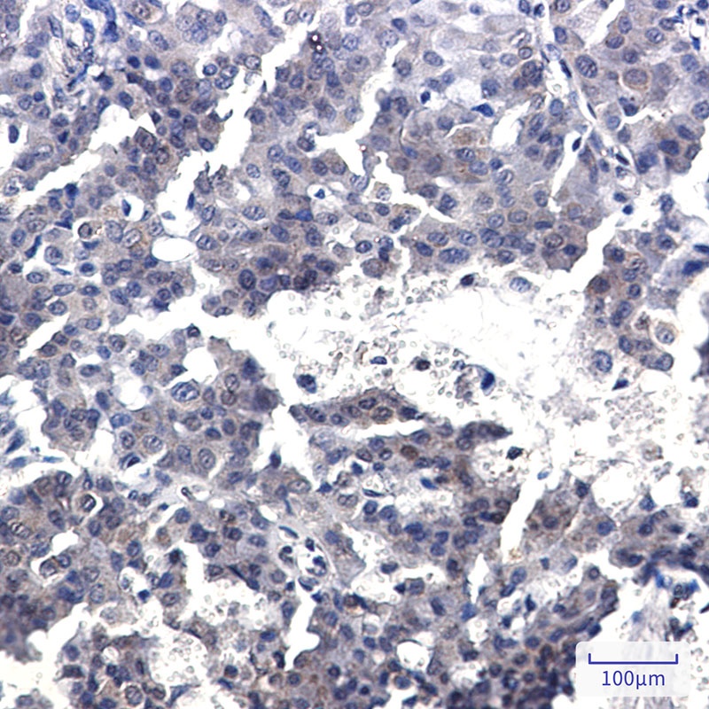 CRTC2 Antibody