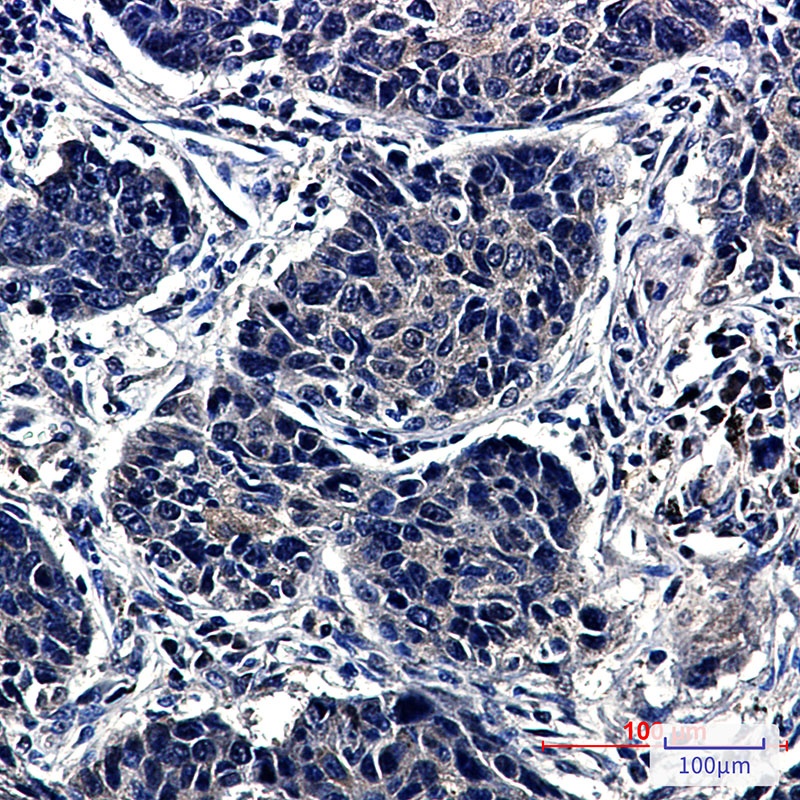 TCP 1 alpha Rabbit Monoclonal Antibody