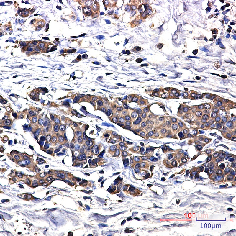 Superoxide Dismutase 1 Rabbit Monoclonal Antibody