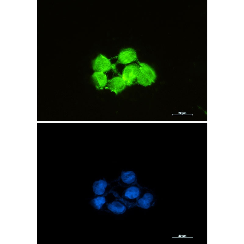 Superoxide Dismutase 1 Rabbit Monoclonal Antibody