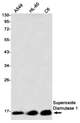 Superoxide Dismutase 1 Rabbit Monoclonal Antibody