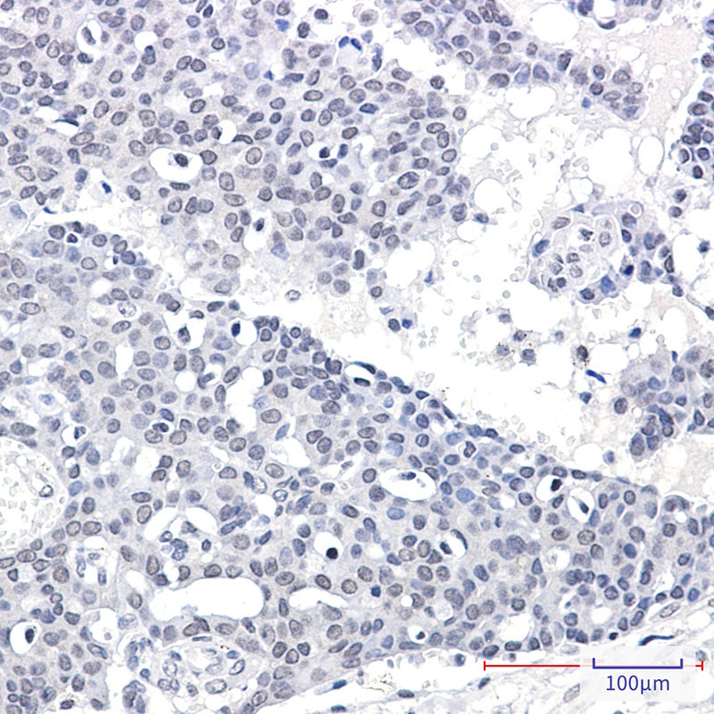 SUPT5H Antibody