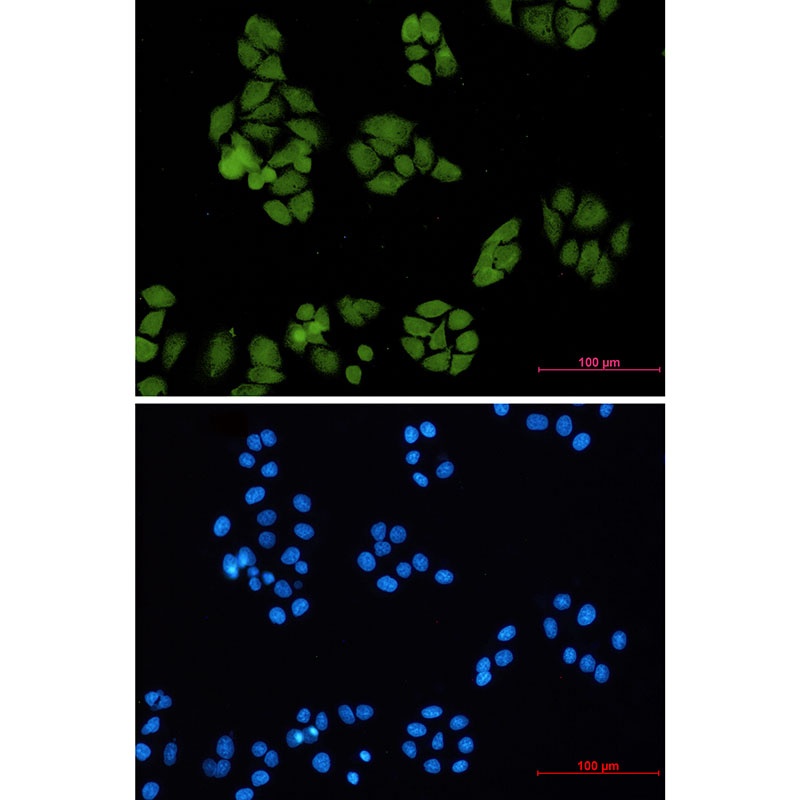 SMAD4 Antibody