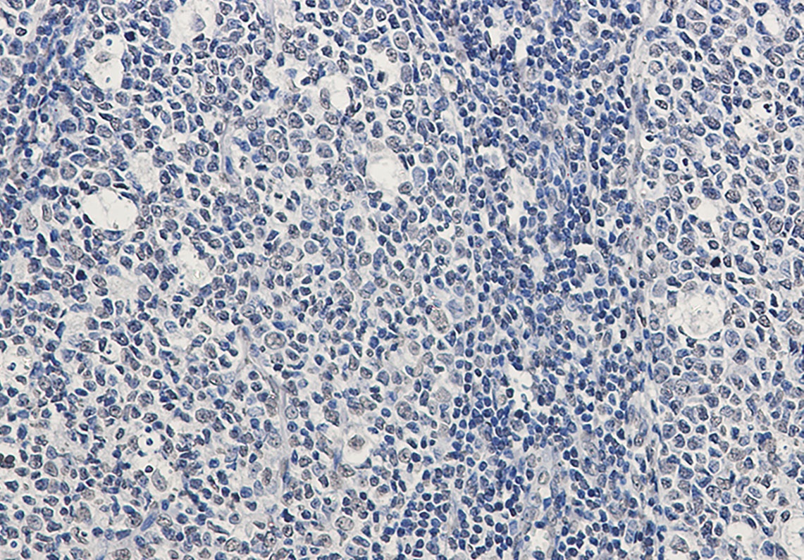 Rad51 Rabbit Monoclonal Antibody