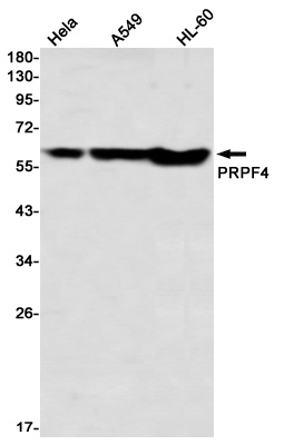 PRPF4 Rabbit Monoclonal Antibody