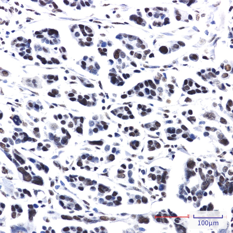 PRPF4 Rabbit Monoclonal Antibody