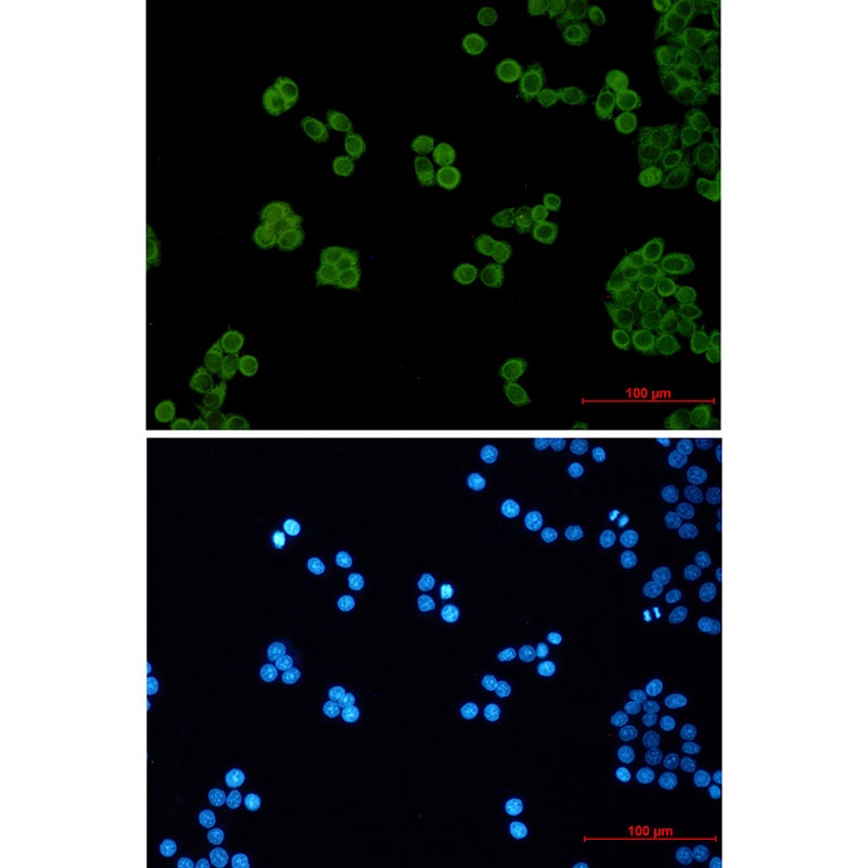 PSENEN Antibody