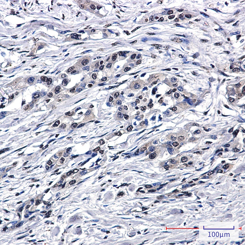 PSENEN Antibody