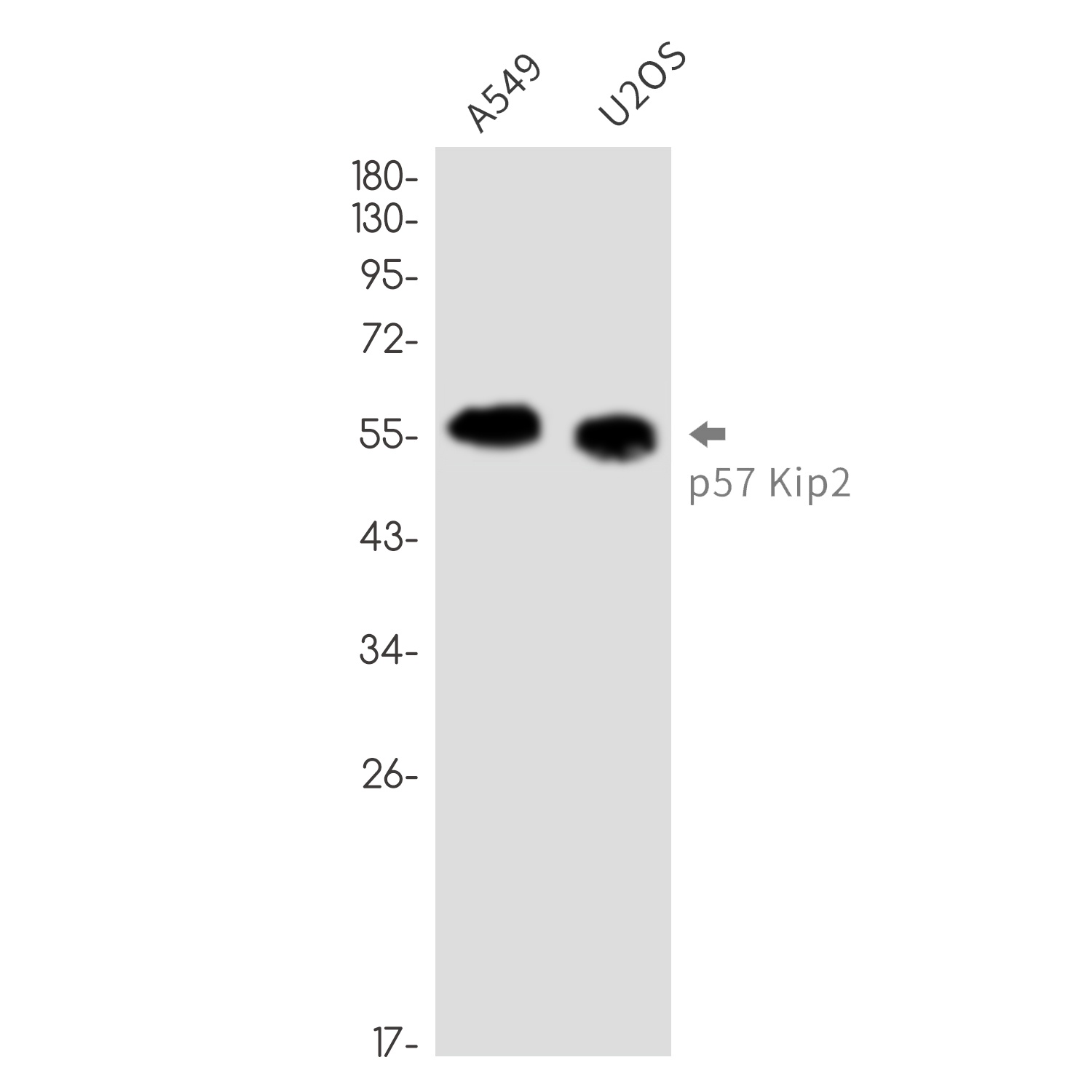 p57 Kip2 Rabbit Monoclonal Antibody