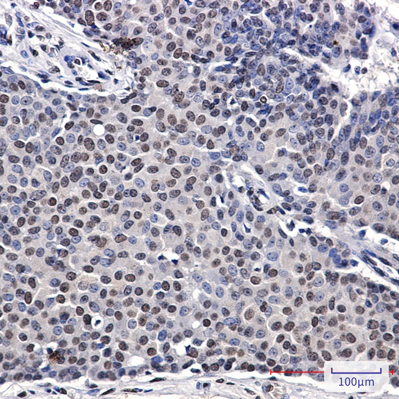 p57 Kip2 Rabbit Monoclonal Antibody