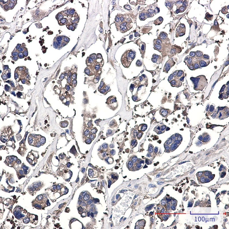 OPTN Antibody