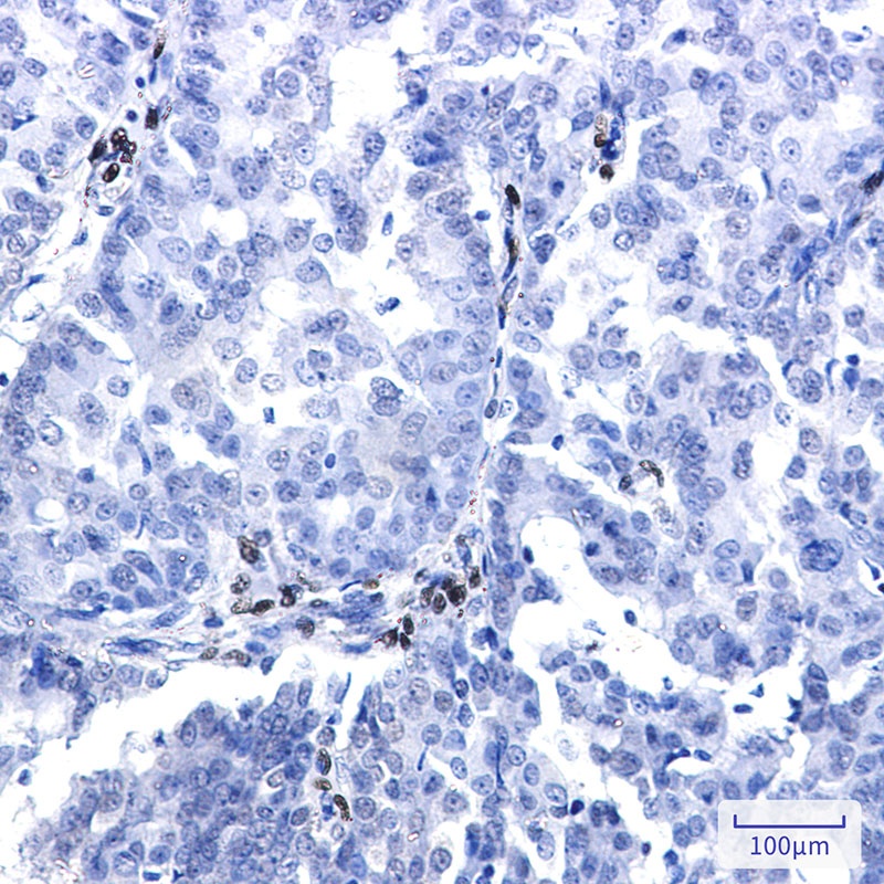 NR2F2 Antibody