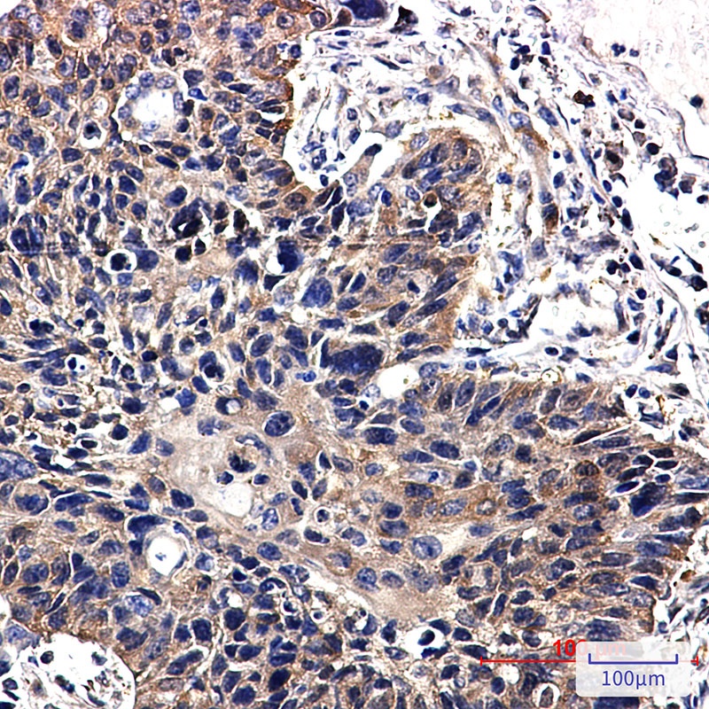 NME2 Rabbit Monoclonal Antibody
