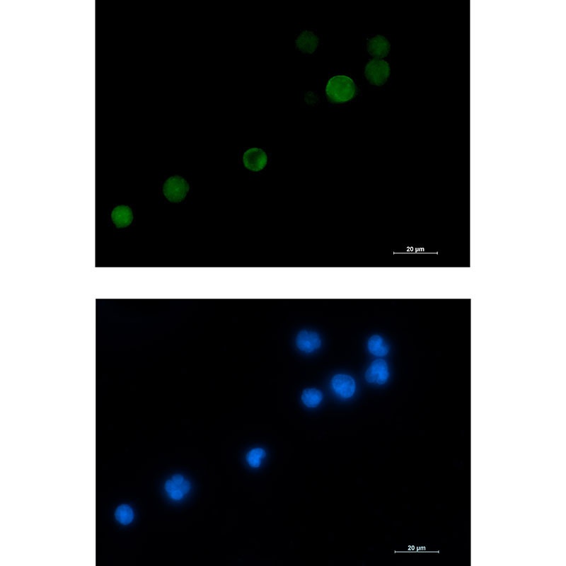 KIF2C Antibody