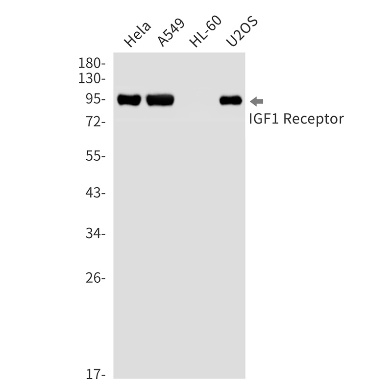 IGF1 Receptor Rabbit Monoclonal Antibody