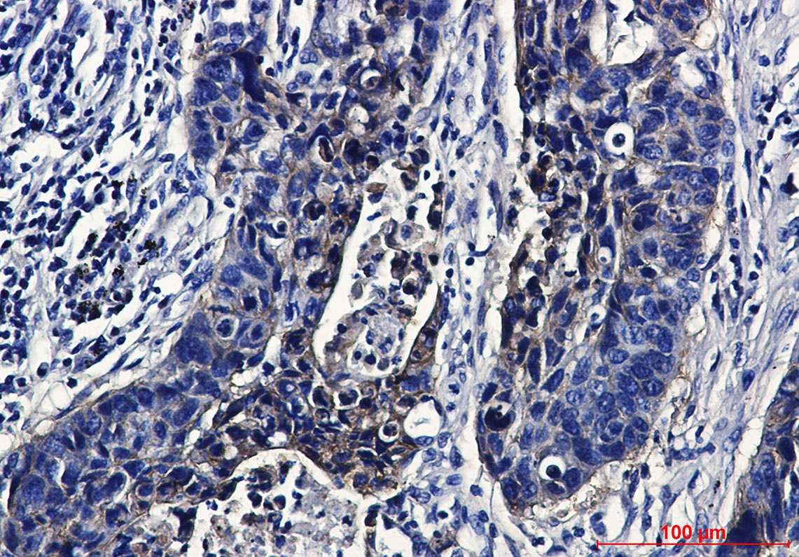 IGF1 Receptor Rabbit Monoclonal Antibody