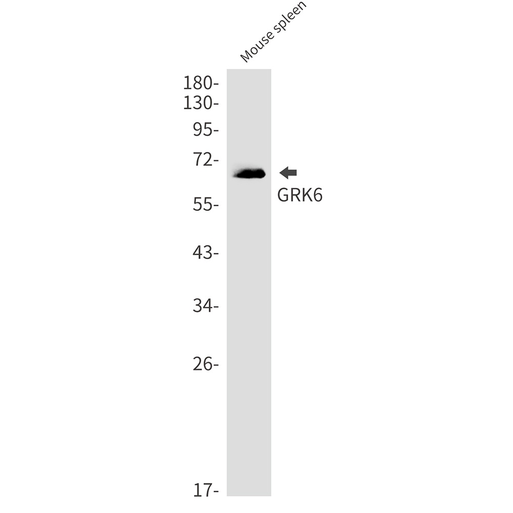GRK6 Antibody