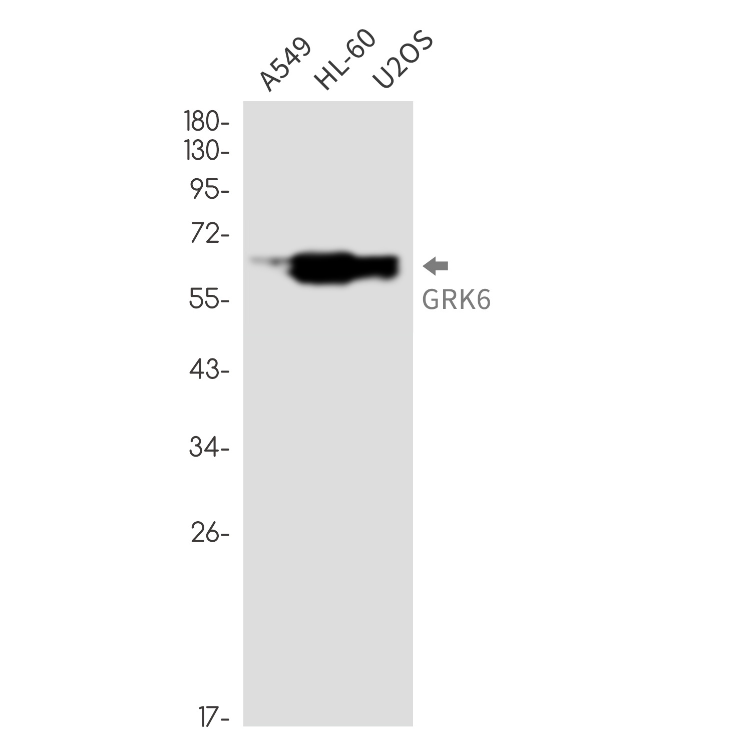 GRK6 Antibody