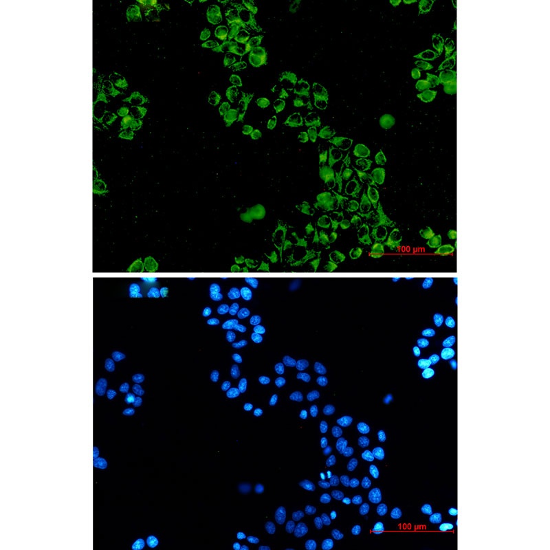 GC1q R Rabbit Monoclonal Antibody