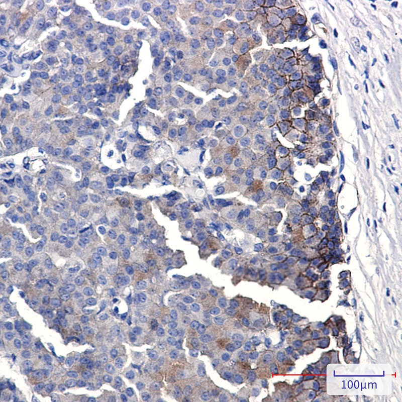 EPHB4 Antibody