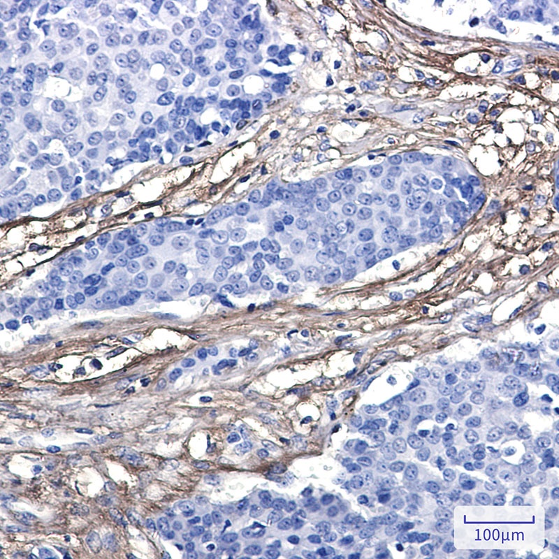 EFEMP1 Antibody