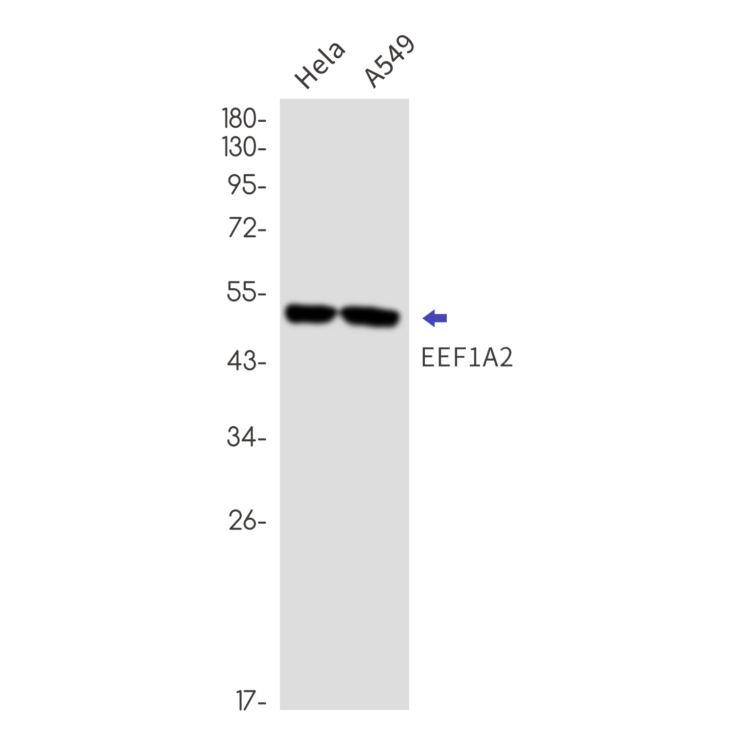 EEF1A2 Antibody