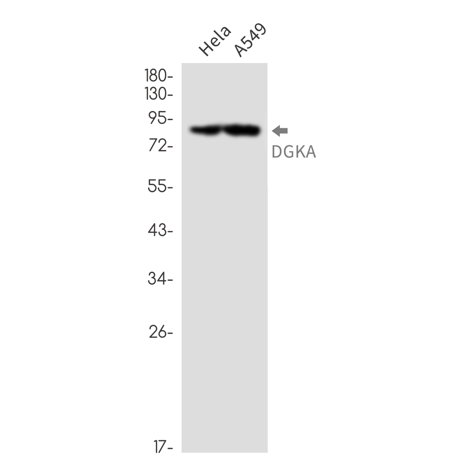 DGKA Antibody