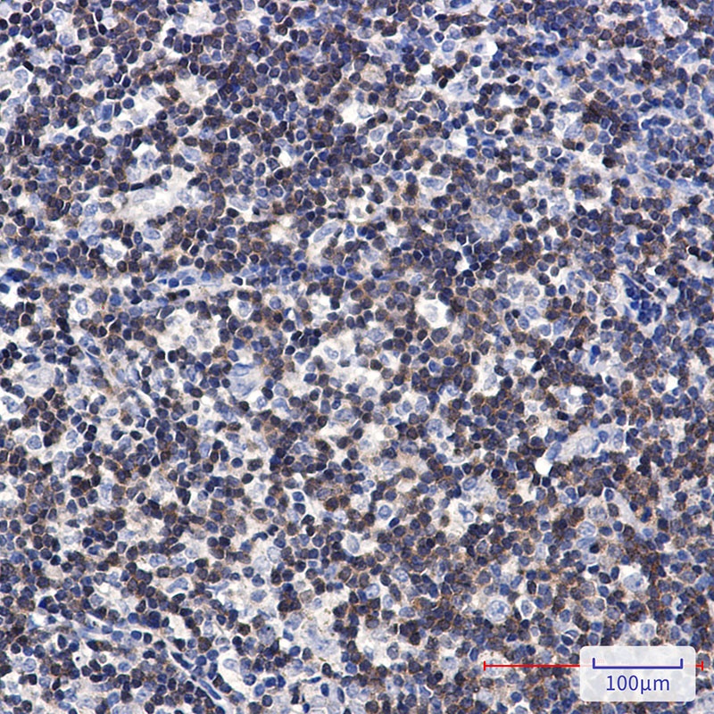 DGKA Antibody