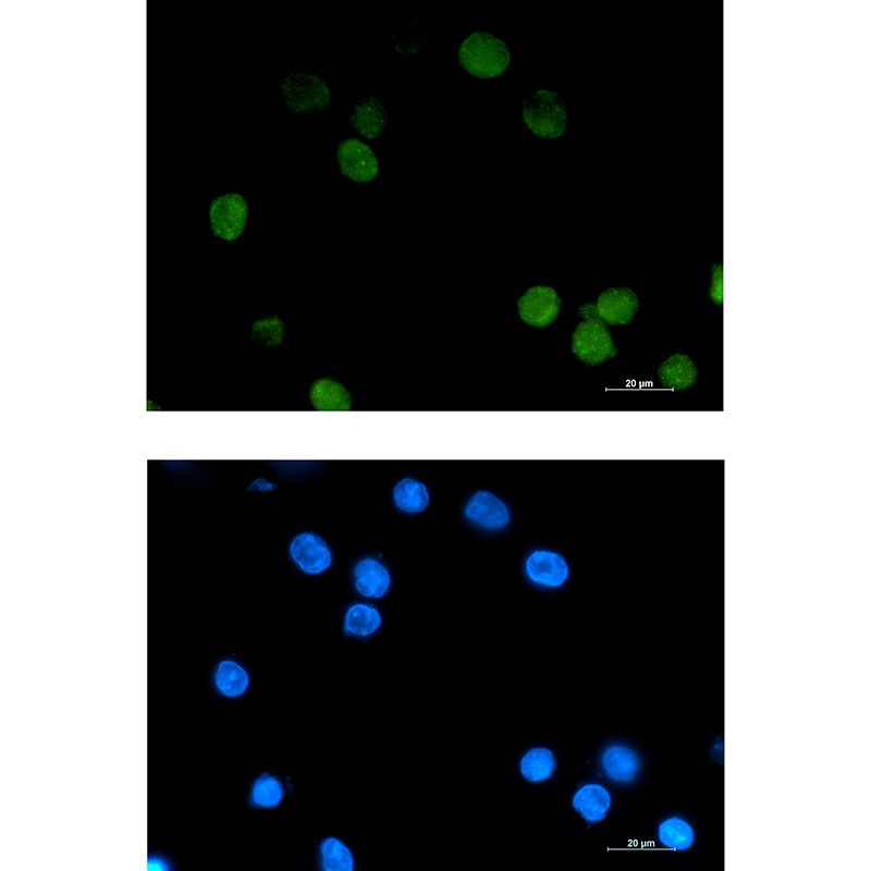 DAXX Antibody