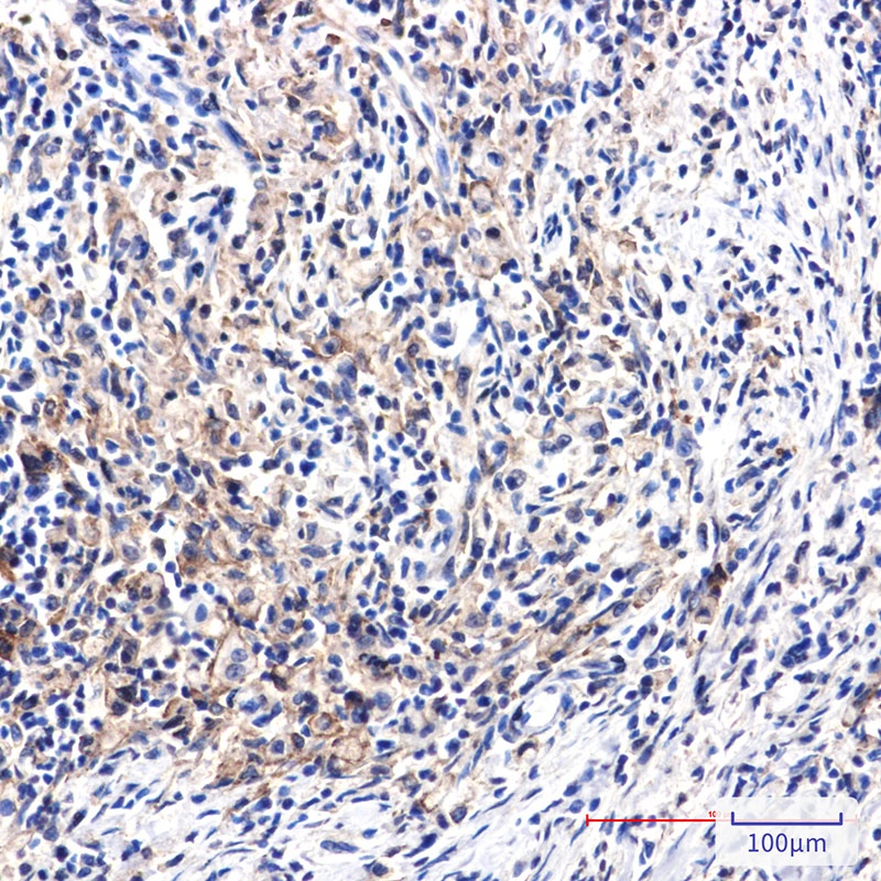 DAB2 Antibody