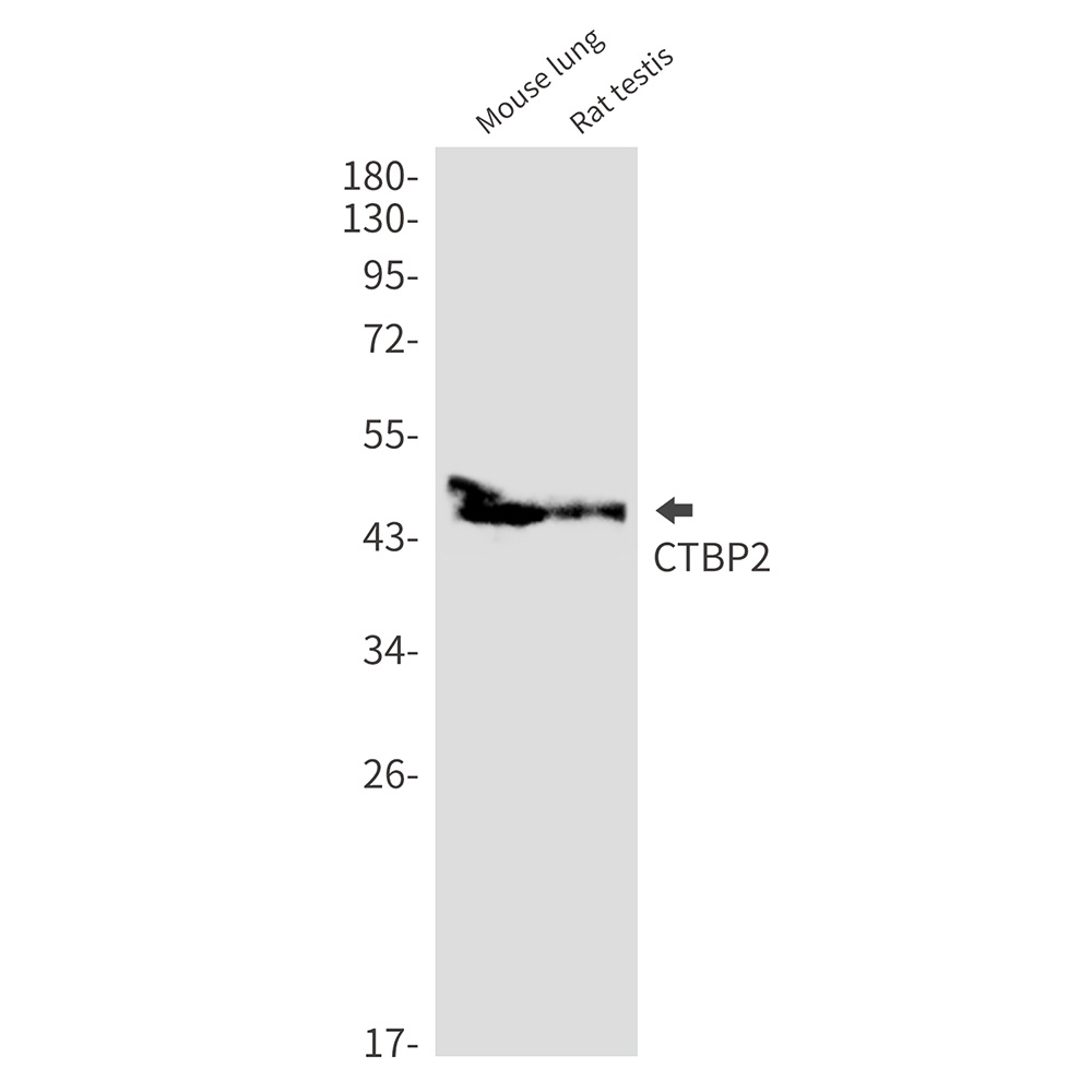 CTBP2 Antibody