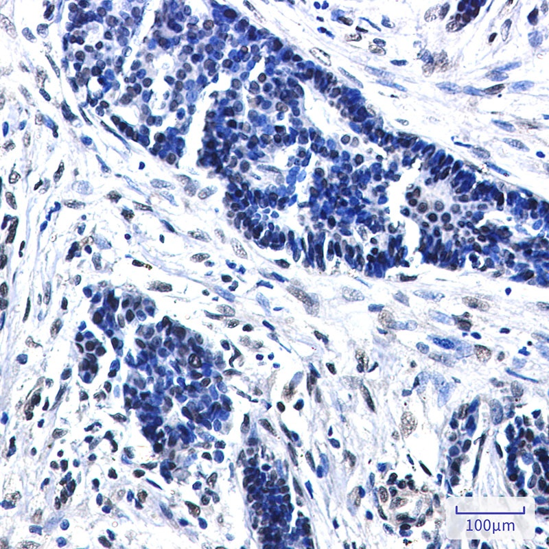 CTBP2 Antibody