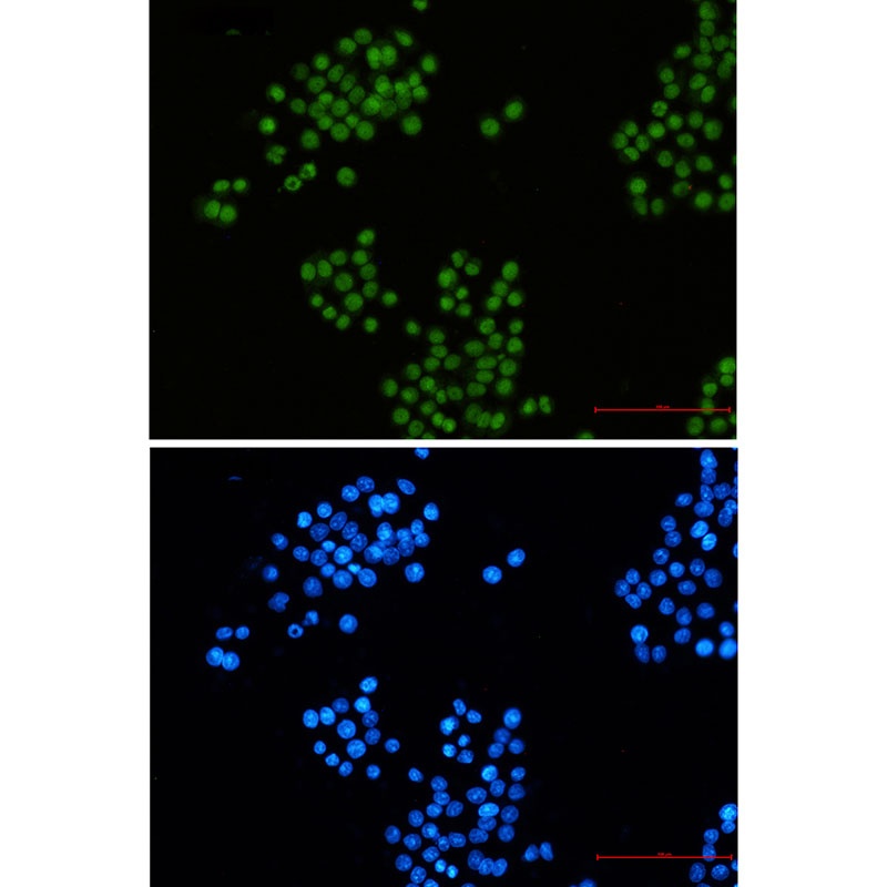 CTBP2 Antibody