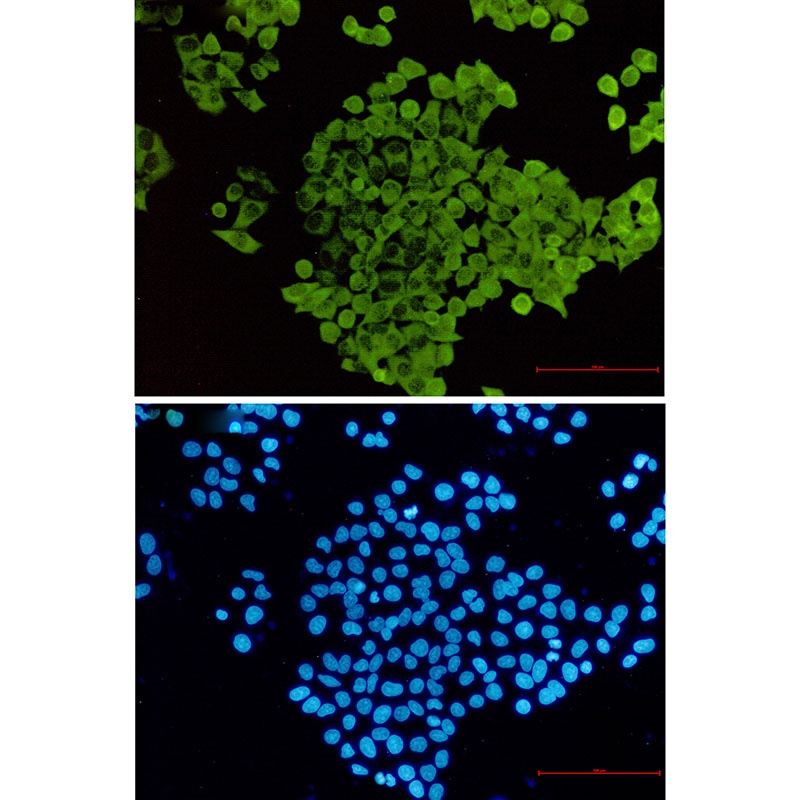 CFL1 Antibody