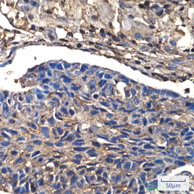 CFL1 Antibody