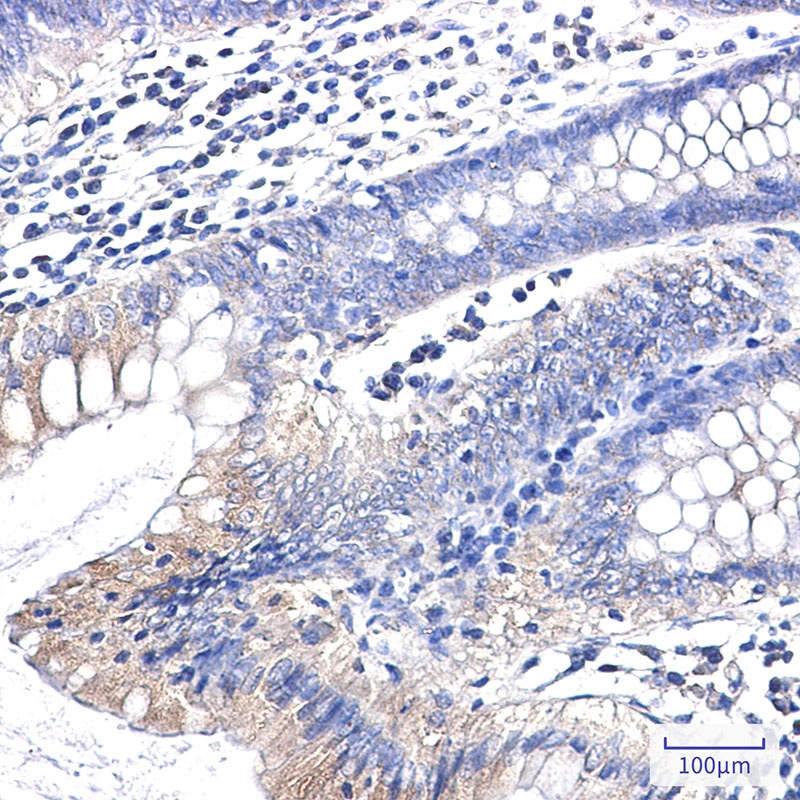 CLTC Antibody